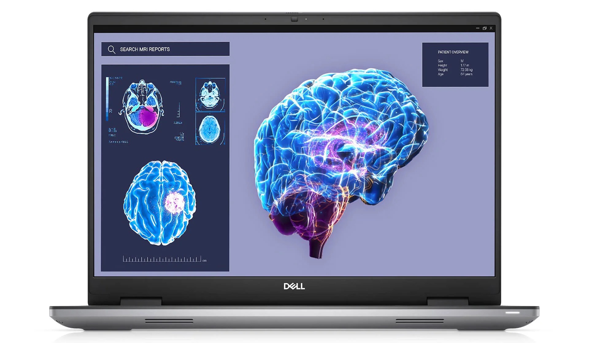 Dell Precision 7680 - Hiệu năng Intel Gen 13 và những lưu ý thực tế